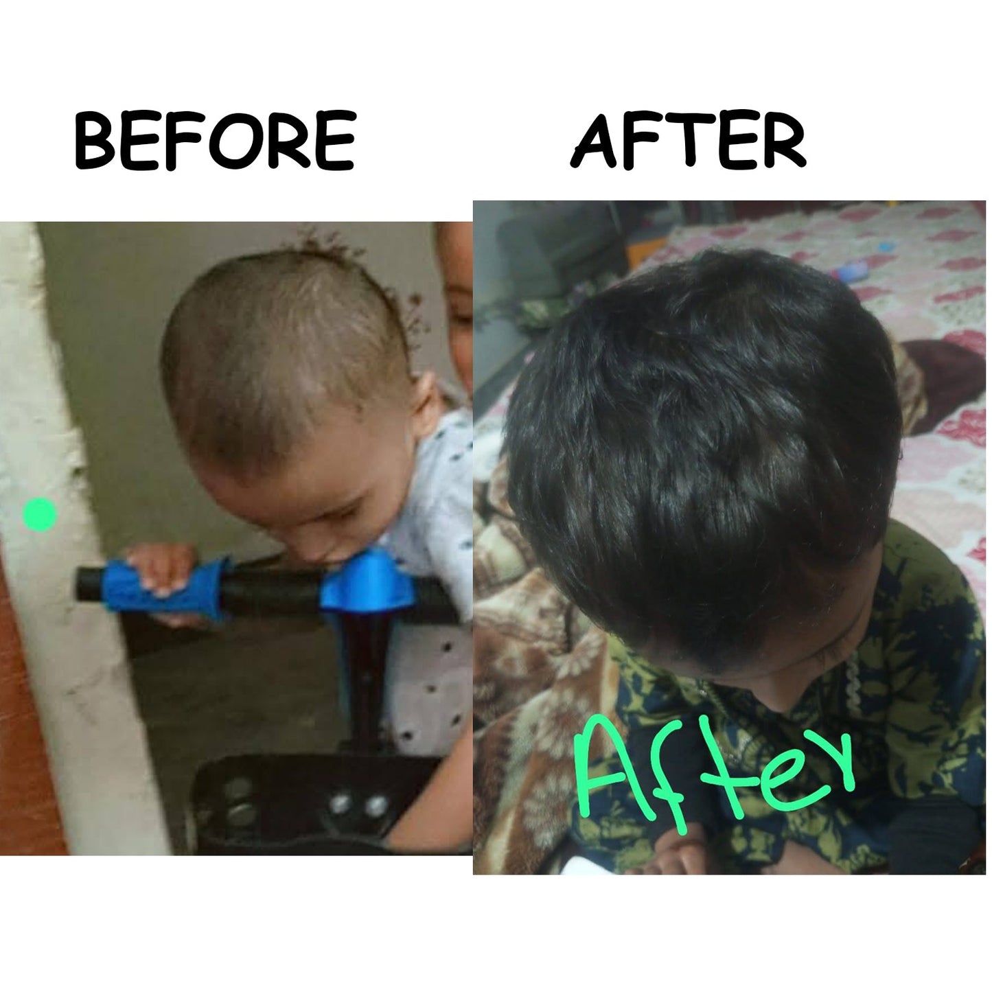 Hair Growth Golden Shampoo