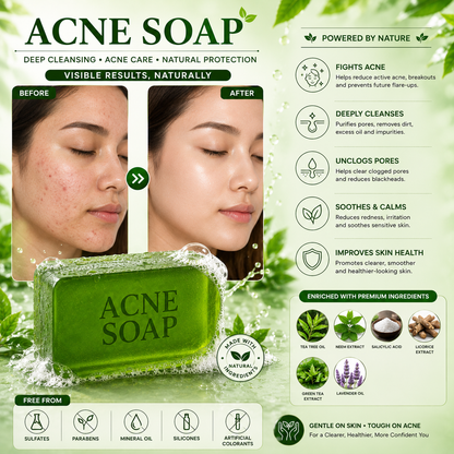 Acne Soap
