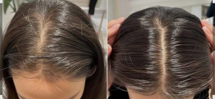Hair Growth Golden Oil