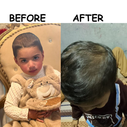 Hair Growth Golden Oil