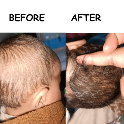 Hair Growth Golden Oil