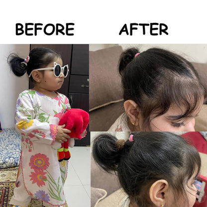 Hair Growth Golden Shampoo