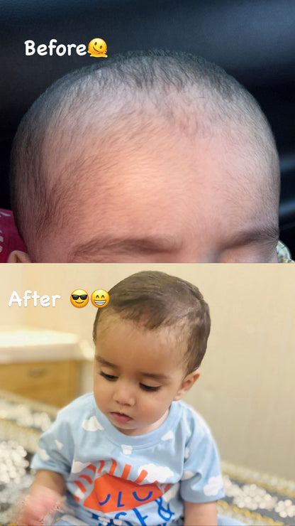 Hair Growth Golden Shampoo