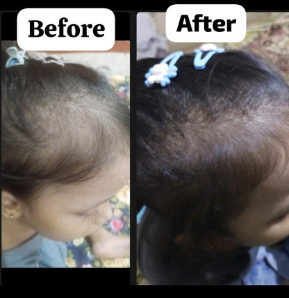 Hair Growth Golden Shampoo