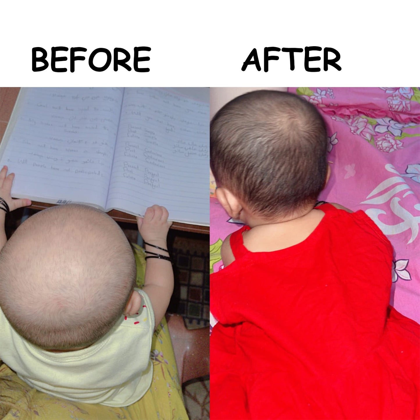 Hair Growth Golden Shampoo