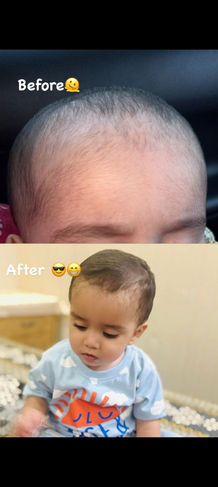 Hair Growth Golden Shampoo