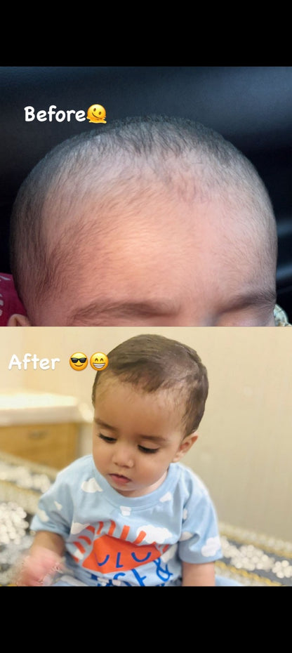 Hair Growth Golden Shampoo