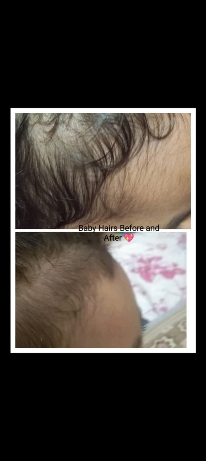 Hair Growth Golden Shampoo