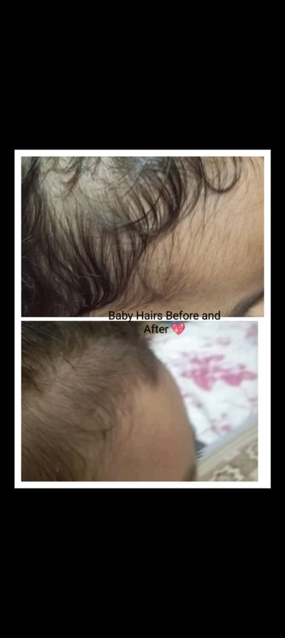 Hair Growth Golden Shampoo