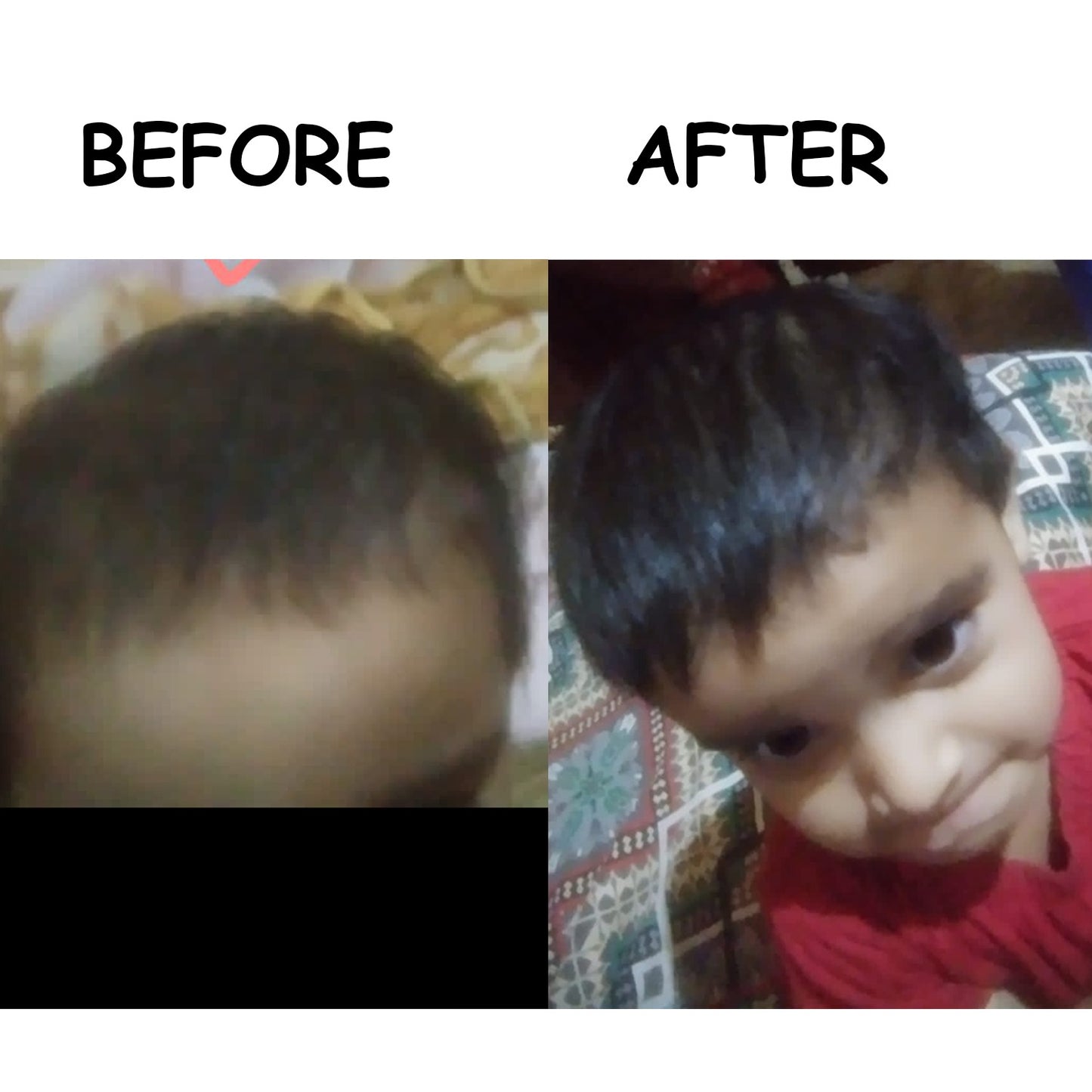 Hair Growth Golden Oil